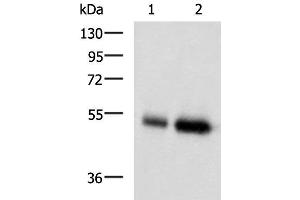 Western blot analysis of Human placenta tissue and Human right lower lung tissue lysates using BMP5 Polyclonal Antibody at dilution of 1:450 (BMP5 antibody)