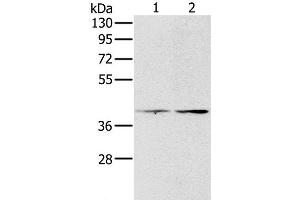 Western Blot analysis of Hela and lovo cell using PDGFRL Polyclonal Antibody at dilution of 1:400 (PDGFRL antibody)