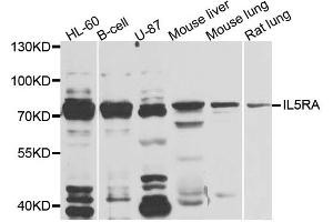 Western blot analysis of extracts of various cell lines, using IL5RA antibody. (IL5RA antibody)
