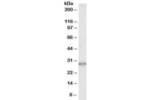 Western blot testing of human liver lysate with CA1 antibody at 0. (CA1 antibody)