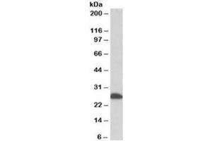 Western blot testing of human liver lysate with ETFB antibody at 0. (ETFB antibody)