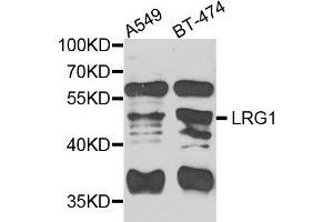 Western blot analysis of extracts of various cell lines, using LRG1 antibody. (LRG1 antibody)