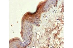 Immunohistochemistry of paraffin-embedded human skin tissue using ABIN7157440 at dilution of 1:100