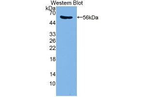 Western blot analysis of the recombinant protein. (PDE4D antibody  (AA 581-809))