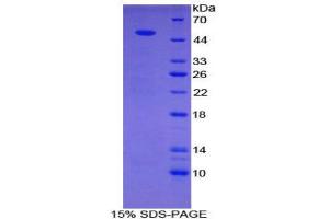 SDS-PAGE (SDS) image for Sema Domain, Immunoglobulin Domain (Ig), Transmembrane Domain (TM) and Short Cytoplasmic Domain, (Semaphorin) 4B (SEMA4B) (AA 644-832) protein (His tag,GST tag) (ABIN1879537)