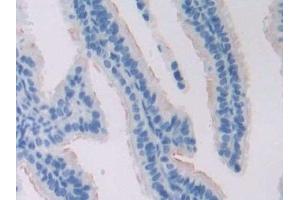 Immunohistochemistry (IHC) image for anti-Adenylate Cyclase 6 (ADCY6) (AA 314-501) antibody (ABIN7441871)