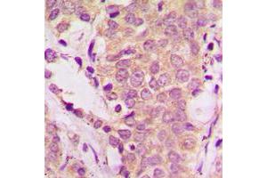 Immunohistochemistry (IHC) image for anti-SHC (Src Homology 2 Domain Containing) Transforming Protein 1 (SHC1) (pTyr349) antibody (ABIN7301284)