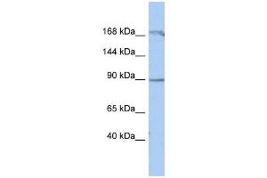 NARG1 antibody used at 1 ug/ml to detect target protein. (NAA15 antibody  (Middle Region))