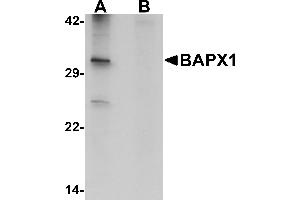 Western blot analysis of BAPX1 in human brain tissue lysate with BAPX1 antibody at 1 µg/mL in (A) the absence and (B) the presence of blocking peptide.