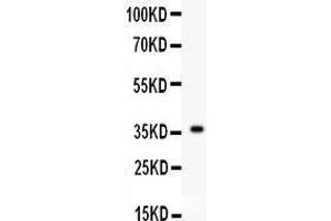 Western Blotting (WB) image for anti-Fibroblast Growth Factor 1 (Acidic) (FGF1) (AA 22-146) antibody (ABIN3042389) (FGF1 antibody  (AA 22-146))