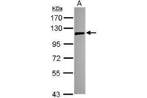 WB Image Sample (30 ug of whole cell lysate) A: 293T 7. (TLR5 antibody)