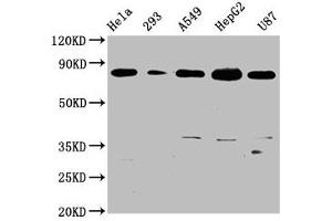 Western Blot Positive WB detected in: Hela whole cell lysate, 293 whole cell lysate, A549 whole cell lysate, HepG2 whole cell lysate, U87 whole cell lysate All lanes: BAG3 antibody at 0.