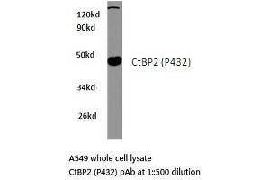 Western blot (WB) analysis of CtBP2 antibody in extracts from A549 cells. (CTBP2 antibody)