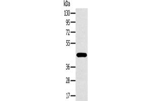Western Blotting (WB) image for anti-Melanoma Antigen Family A, 10 (MAGEA10) antibody (ABIN2423753) (MAGEA10 antibody)