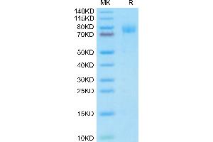 Mouse MUC18 on Tris-Bis PAGE under reduced condition. (MCAM Protein (AA 24-563) (His tag))