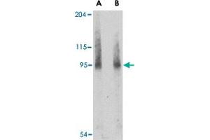 Western blot analysis of BICD2 in A-549 cell lysate with BICD2 polyclonal antibody  at (A) 1 and (B) 2 ug/mL . (BICD2 antibody  (Internal Region))