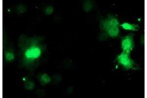 Image no. 2 for anti-Chromosome 17 Open Reading Frame 37 (C17orf37) antibody (ABIN1501776) (C17orf37 antibody)