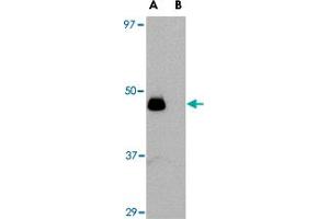 Western blot analysis of IL34 in human brain tissue lysate with IL34 polyclonal antibody  at 0.