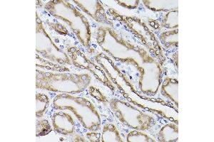 Immunohistochemistry (IHC) image for anti-Prolyl 4-Hydroxylase, beta Polypeptide (P4HB) antibody (ABIN6134876)