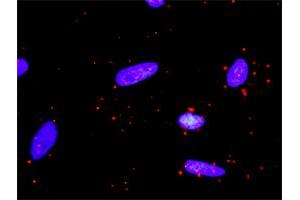 Proximity Ligation Analysis of protein-protein interactions between PIK3R1 and CSF1R. (CSF1R antibody  (AA 21-120))