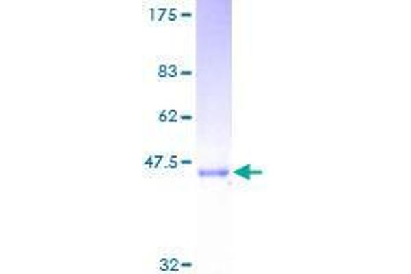 SAR1B Protein (AA 1-198) (GST tag)