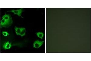 Immunofluorescence analysis of COS7 cells, using CYSLTR1 Antibody. (CysLTR1 antibody  (AA 131-180))