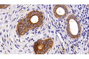 Immunohistochemistry (IHC) image for anti-Keratin 6A (KRT6A) (AA 163-468) antibody (ABIN7435445)