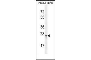 Western blot analysis of C16orf45 Antibody (Center) in NCI-H460 cell line lysates (35ug/lane). (C16orf45 antibody  (Middle Region))