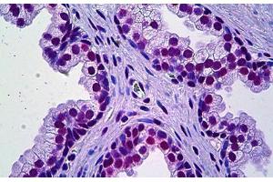 Human Prostate: Formalin-Fixed, Paraffin-Embedded (FFPE) (PRKDC antibody  (AA 4019-4129))
