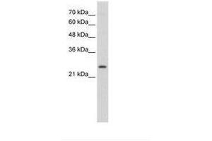 Image no. 1 for anti-Thyroid Stimulating Hormone Receptor (TSHR) (C-Term) antibody (ABIN6736337) (TSH receptor antibody  (C-Term))