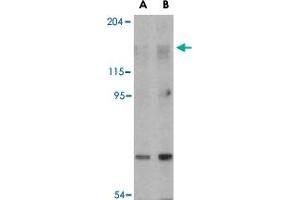 Western blot analysis of RPTOR in L1210 cell lysate with RPTOR polyclonal antibody  at (A) 2 and (B) 4 ug/mL . (Raptor antibody  (N-Term))