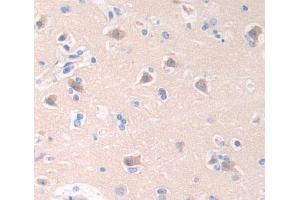 Used in DAB staining on fromalin fixed paraffin- embedded brain tissue (Cathepsin W antibody  (AA 22-376))