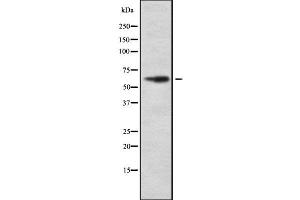 Western blot analysis of HIC-2 using COLO205 whole cell lysates (HIC2 antibody  (Internal Region))