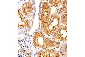 Iunohistochemical analysis of paraffin-embedded H. (MME antibody  (AA 492-525))