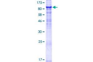 MON1A Protein (AA 1-555) (GST tag)