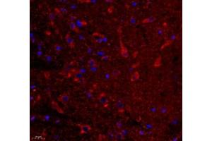 Immunofluorescence of paraffin embedded rat substantia nigra using VIRL2 (ABIN7076206) at dilution of 1: 700 (400x lens) (VN1R2 antibody)