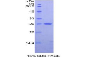 SDS-PAGE analysis of Rat APC Protein. (APC Protein)