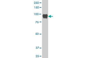 LLGL1 polyclonal antibody (A01), Lot # 060814QCS1 Western Blot analysis of LLGL1 expression in Jurkat . (LLGL1 antibody  (AA 911-1010))