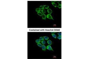 ICC/IF Image Immunofluorescence analysis of methanol-fixed HCT116, using C1r, antibody at 1:500 dilution. (C1R antibody)
