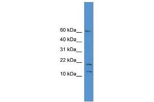 WB Suggested Anti-SNAPC5 Antibody Titration: 0. (SNAPC5 antibody  (N-Term))