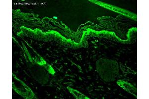 Immunohistochemistry analysis using Mouse Anti-Hsp27 Monoclonal Antibody, Clone 8A7 . (HSP27 antibody  (Atto 390))