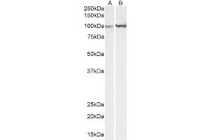 Western Blotting (WB) image for anti-Actinin, alpha 1 (ACTN1) (AA 596-609) antibody (ABIN5857549) (ACTN1 antibody  (AA 596-609))