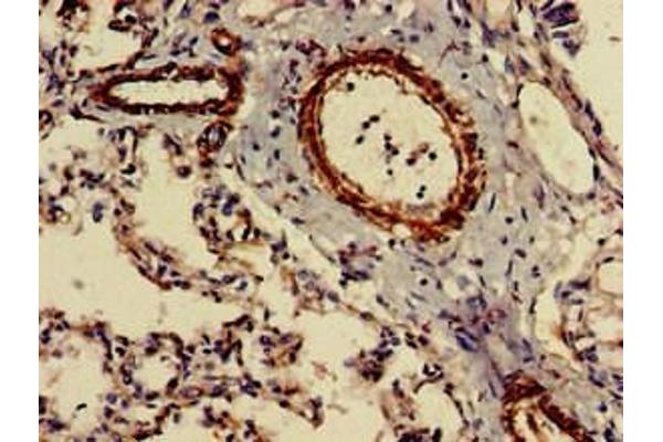 CIDEB antibody  (AA 80-145)
