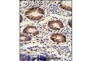 Immunohistochemistry (Paraffin-embedded Sections) (IHC (p)) image for anti-Chloride Channel, Nucleotide-Sensitive, 1A (CLNS1A) (AA 189-216), (C-Term) antibody (ABIN390419)