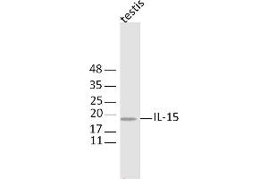Mouse testis lysates probed with IL-11 Polyclonal Antibody, Unconjugated  at 1:300 dilution and 4˚C overnight incubation. (IL-11 antibody  (AA 22-120))