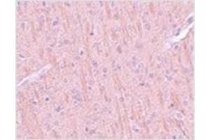 Immunohistochemistry of CCDC106 in rat brain tissue with CCDC106 antibody at 5 μg/ml. (CCDC106 antibody  (C-Term))