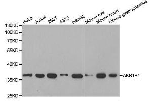 Western blot analysis of extracts of various cell lines, using AKR1B1 antibody. (AKR1B1 antibody  (AA 1-316))