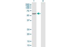 Western Blot analysis of BANP expression in transfected 293T cell line by BANP MaxPab polyclonal antibody. (BANP antibody  (AA 1-469))