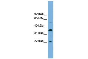 DOK6 antibody used at 1 ug/ml to detect target protein. (DOK6 antibody  (Middle Region))