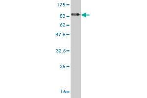 Western Blot detection against Immunogen (81. (EDC3 antibody  (AA 1-508))